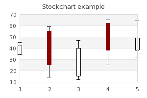 A stock graph (stockex1.php)